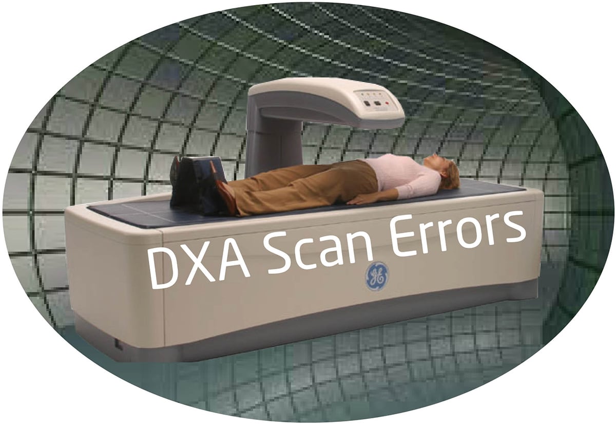 The Sources of Common DXA Scan Errors